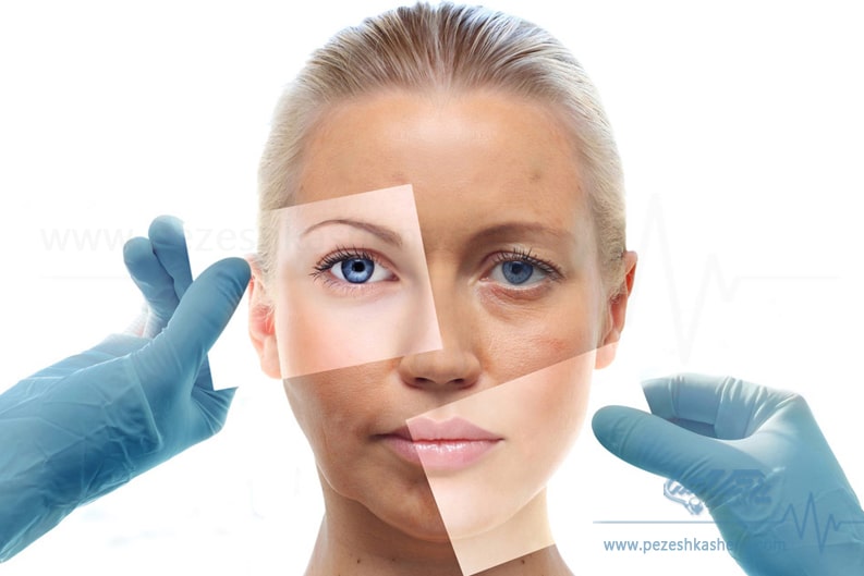 متخصص پوست و مو زیبایی