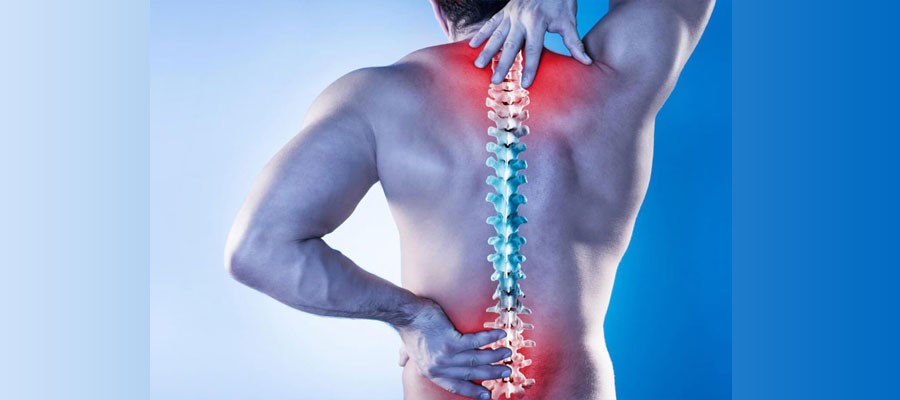 دردهای گردن و کمر ناشی از مشکلات عصبی