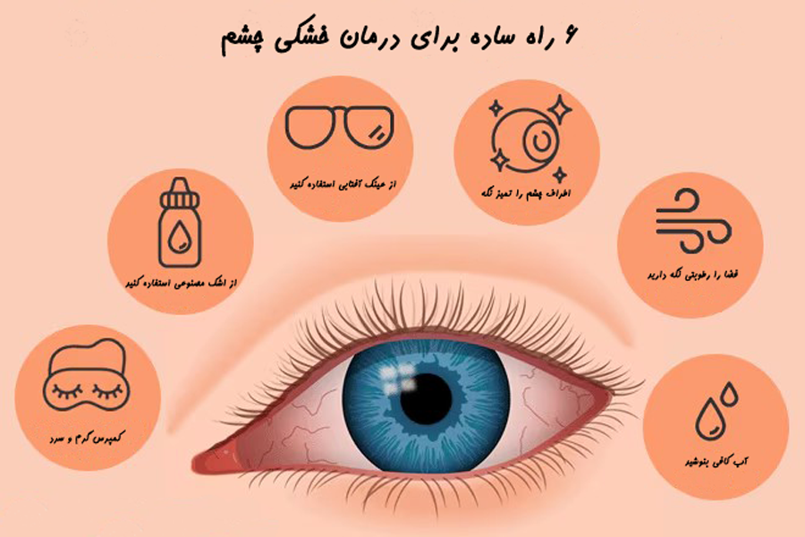 راههایی برای خشکی چشم